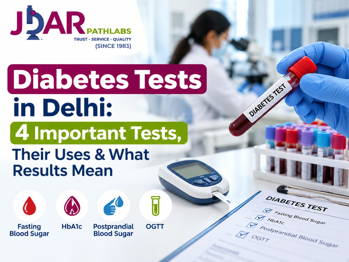 Diabetes Tests in Delhi: 4 Important Tests, Their Uses & What Results Mean
